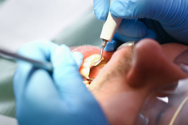 Best Emergency Treatment for Oral Infections in Mount Wolf, PA